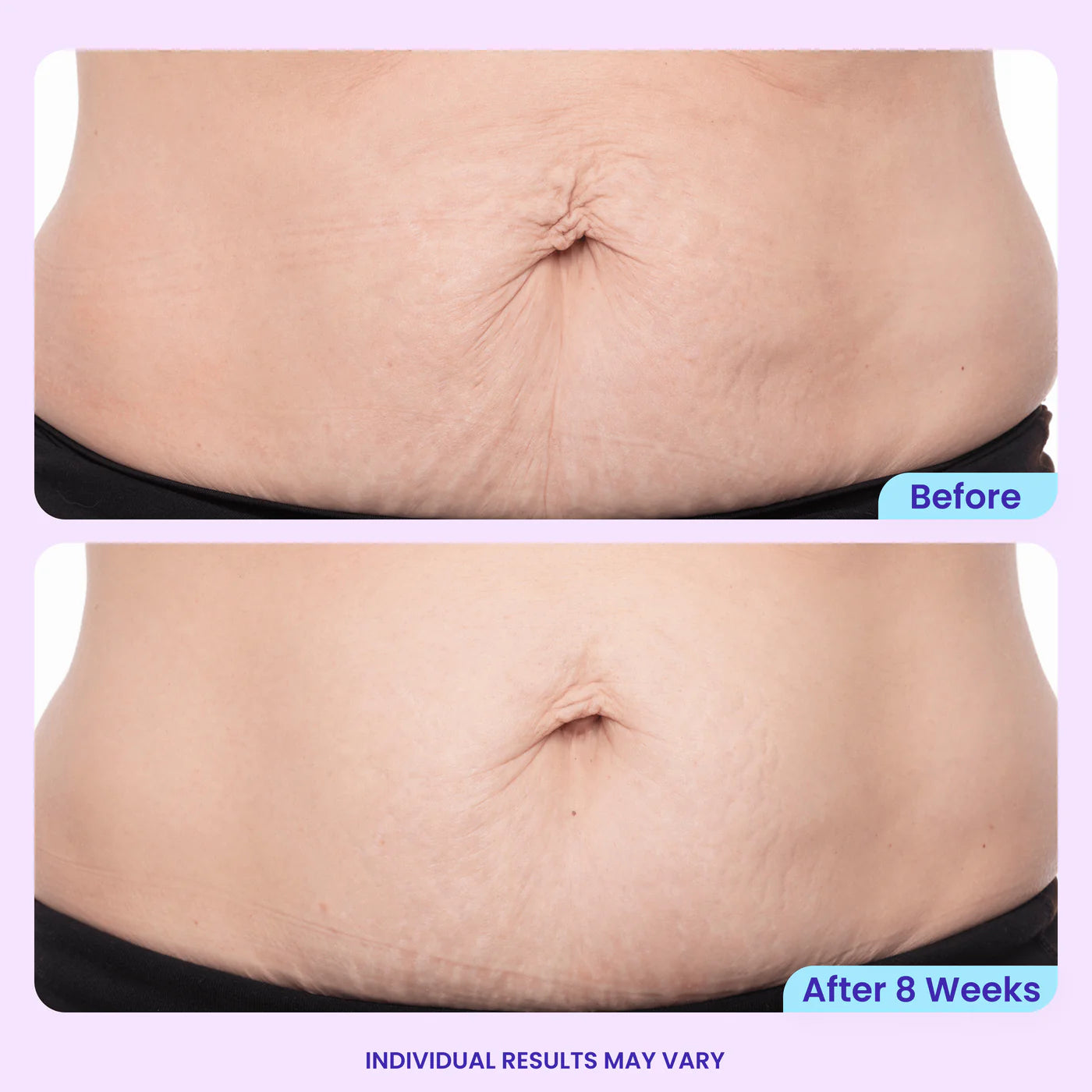 Gopure Belly Firming Cream, Visible Results in 4 Weeks, 60-Day Trial
