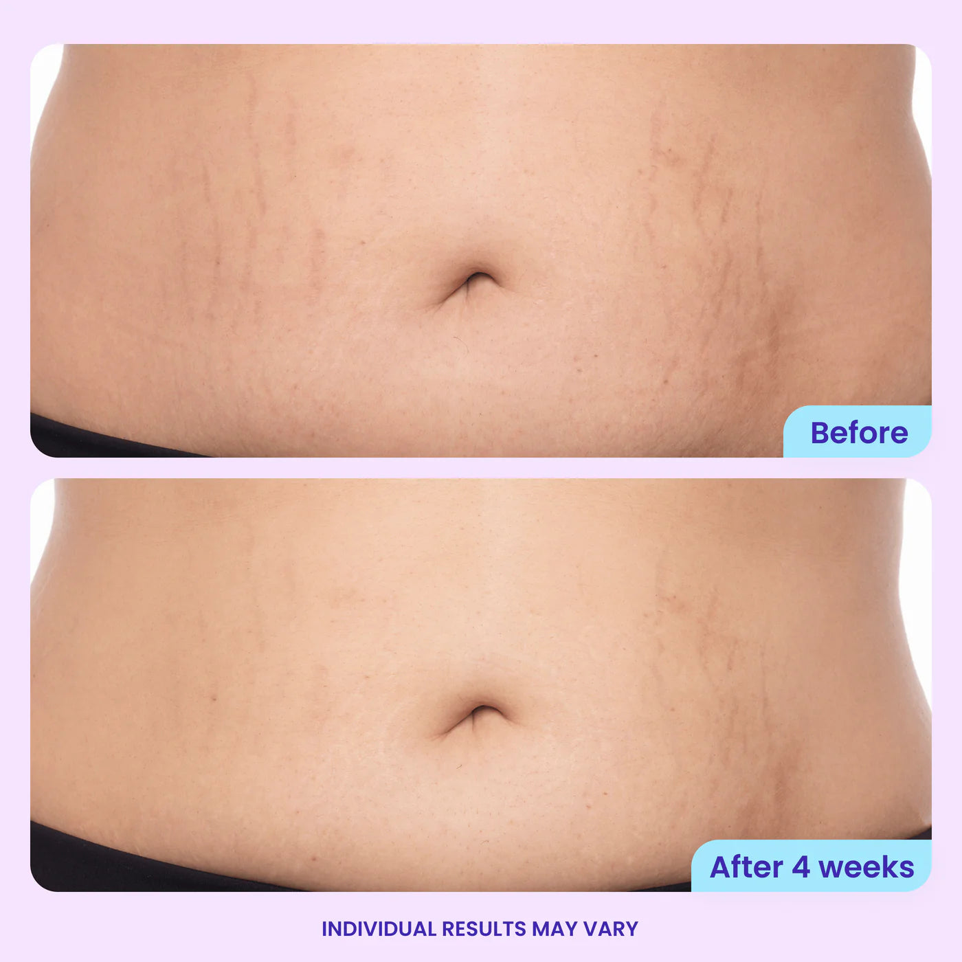 Gopure Belly Firming Cream, Visible Results in 4 Weeks, 60-Day Trial